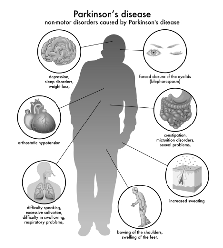 PQQ and Parkinson’s disease